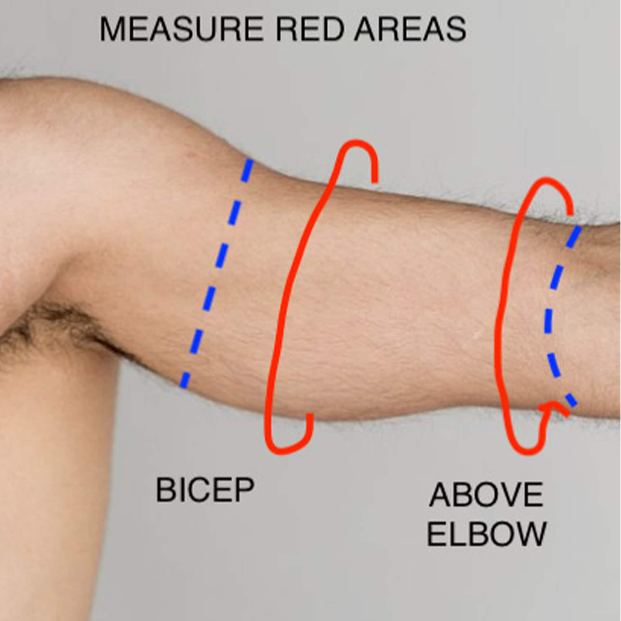 L7.5"-8" Dark Galaxy Bicep PICC Line Cover