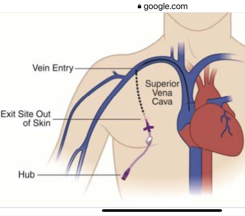 Broviac, Hickman Line Cover|CVL |Short Central Line| Medical Connection Port Cover