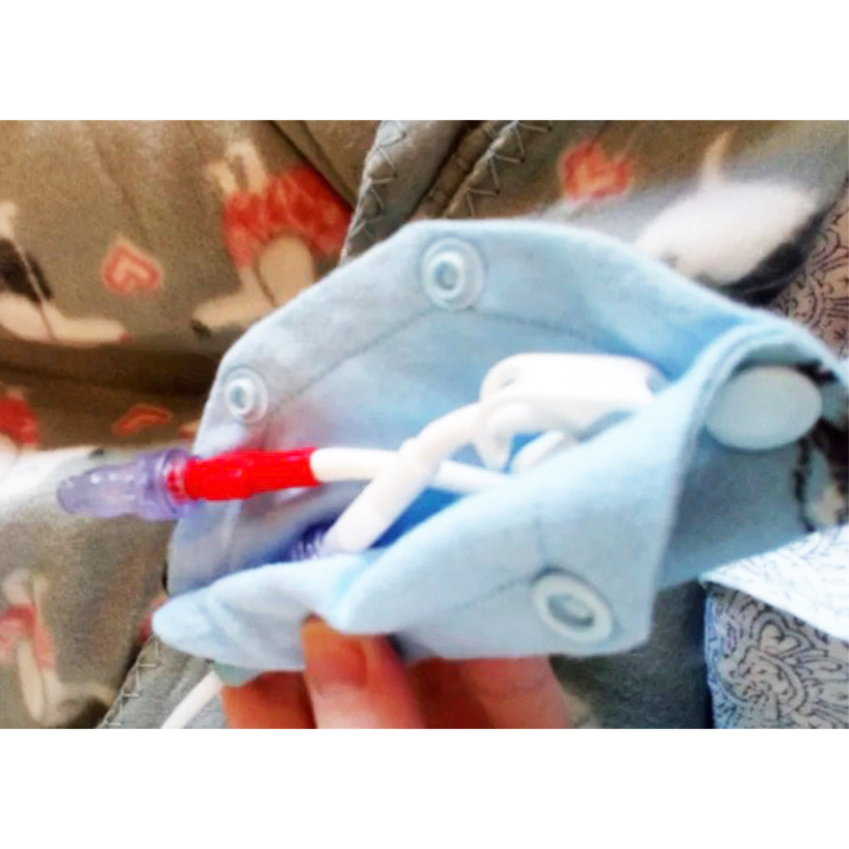 Broviac, Hickman Line Cover|CVL |Short Central Line| Medical Connection Port Cover